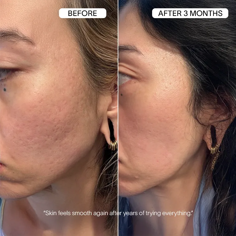 Vanoir Advanced Infusion Treatment