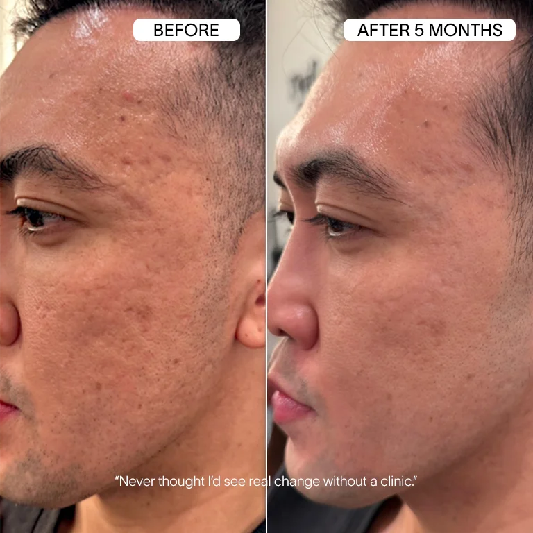Vanoir Advanced Infusion Treatment