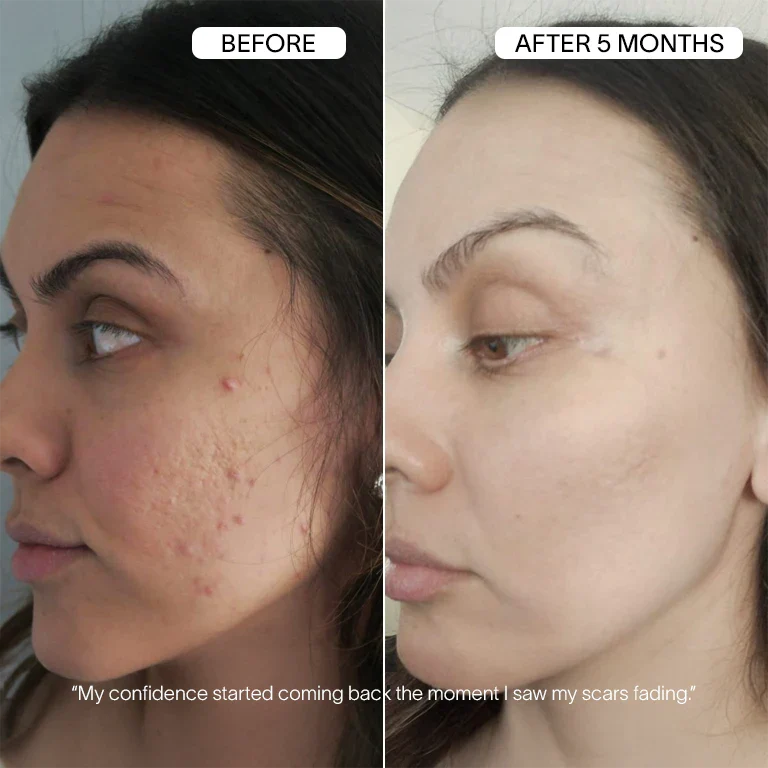 Vanoir Advanced Infusion Treatment