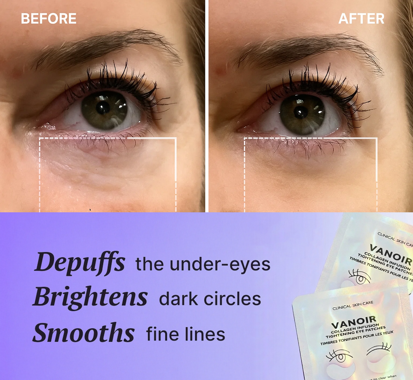 Vanoir Collagen Infusion Eye Patches