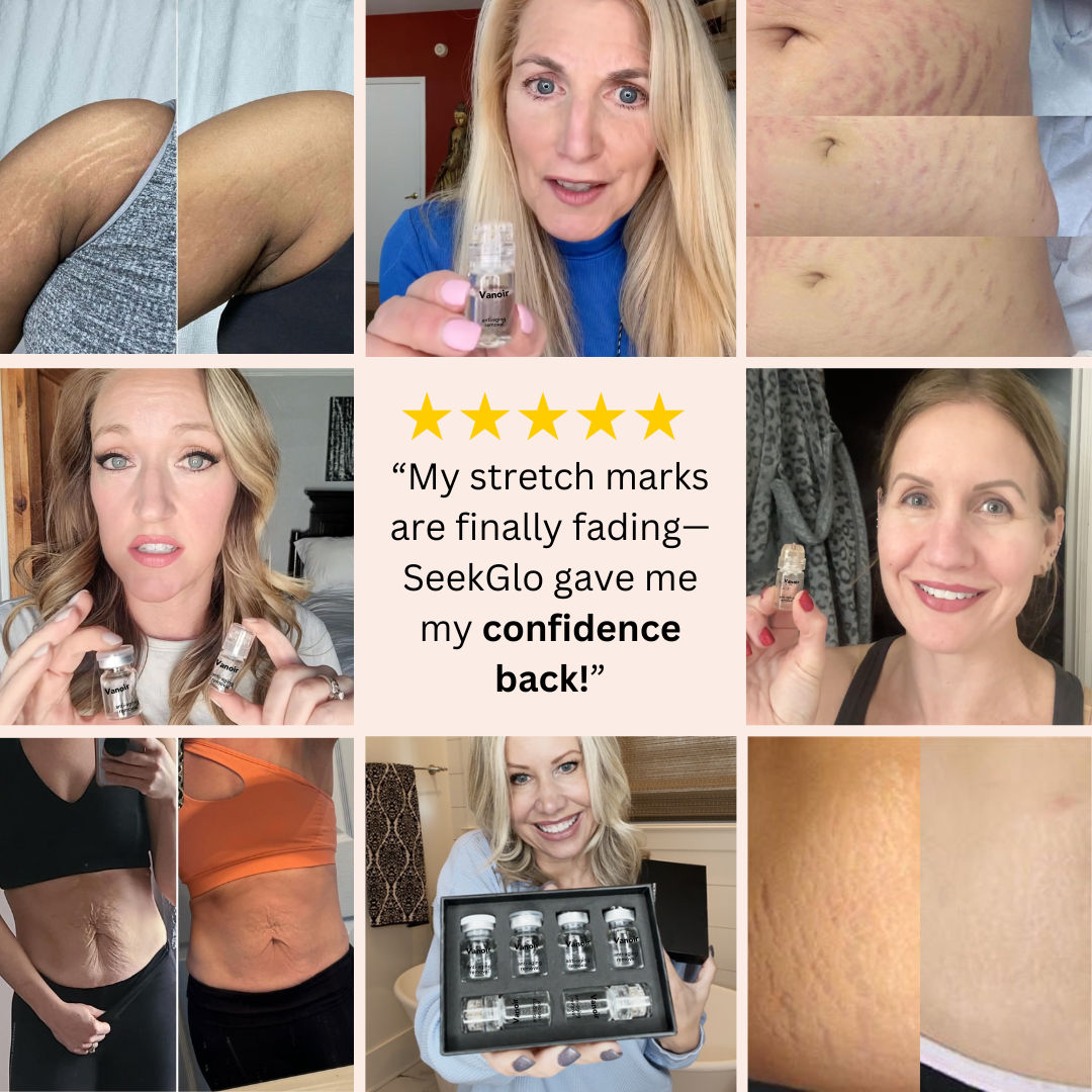 Vanoir Stretch Mark System