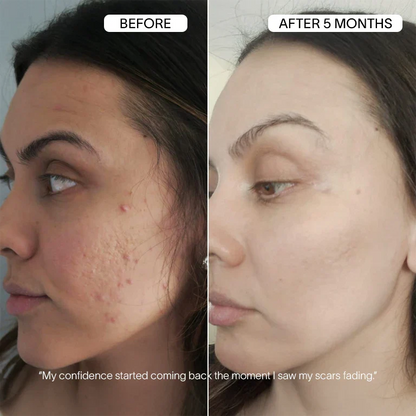 Vanoir Advanced Infusion Treatment