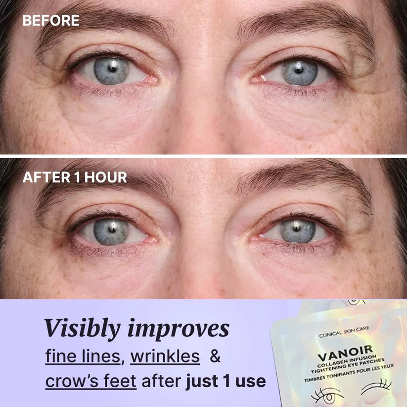 Vanoir Collagen Infusion Eye Patches