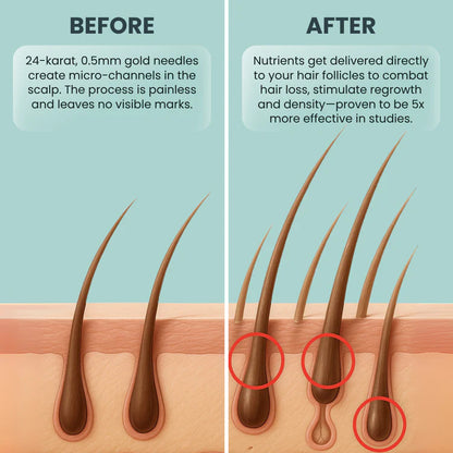 Vanoir™ Regrowth Kit